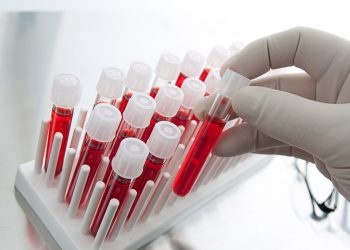 Зургаадугаар сард ДОХ-ын 2 тохиолдол илэрч нийт 316 болсон байна