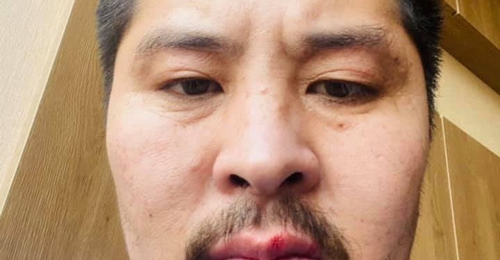 Сэтгүүлч М.Батбилэг Ковидын халдвар авчээ