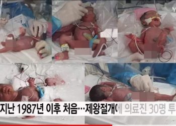 Солонгост 5 ихэр хүүхэд мэндэлжээ