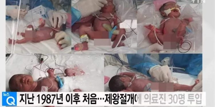 Солонгост 5 ихэр хүүхэд мэндэлжээ