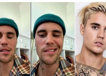 Жастин Бибер нүүрний саажилттай болсон талаараа ярьж, өөрийнхөө төлөө залбирахыг хүслээ