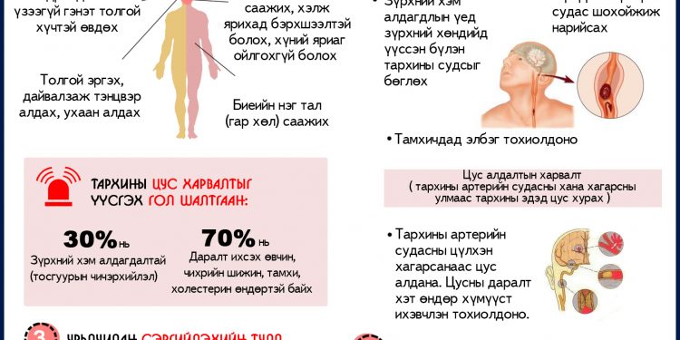 Тархины цус харвалтын тусламж, үйлчилгээг ЭМД-аас бүрэн хариуцна