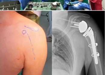 МОНГОЛ УЛСАД АНХ УДАА МӨРНИЙ ҮЕИЙГ БҮТЭН СОЛИХ МЭС ЗАСЛЫГ ЭМЧИЛГЭЭНД НЭВТРҮҮЛЛЭЭ