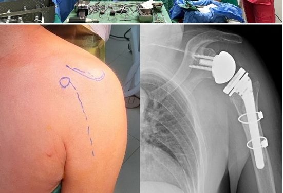 МОНГОЛ УЛСАД АНХ УДАА МӨРНИЙ ҮЕИЙГ БҮТЭН СОЛИХ МЭС ЗАСЛЫГ ЭМЧИЛГЭЭНД НЭВТРҮҮЛЛЭЭ